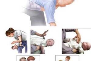Cảnh giác dị vật đường thở